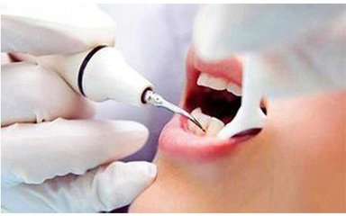 洗牙通常來說需要多長時間洗干凈-易網<a href=http://www.jsjjzhkt.cn/ target=_blank class=infotextkey>健康養生</a>網 洗牙通常來說需要多長時間洗干凈