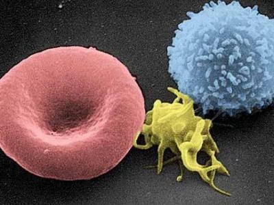 血小板的寬度數值偏高應該怎樣治療