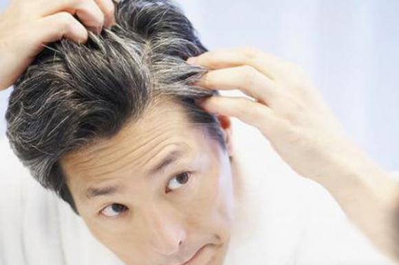 導致年輕人白發越長越多的兩種原因-易網<a href=http://www.jsjjzhkt.cn/ target=_blank class=infotextkey>健康養生</a>網 導致年輕人白發越長越多的兩種原因
