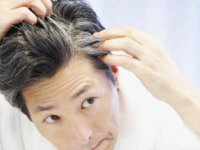 導致年輕人白發(fā)越長越多的兩種原因