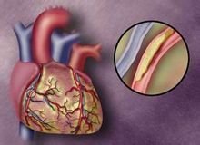 做好這三件事情可以讓你的甘油三酯指標降低-易網健康<a href=http://www.jsjjzhkt.cn/jkys/ target=_blank class=infotextkey>養生</a>網 做好這三件事情可以讓你的甘油三酯指標降低