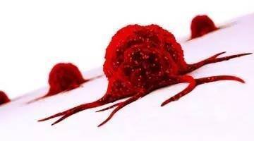 囊腫和腫瘤有什么區別囊腫會變成腫瘤嗎