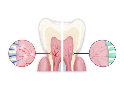 做好這六件事可以很好的預(yù)防牙齒敏感-易網(wǎng)健康<a href=http://www.jsjjzhkt.cn/jkys/ target=_blank class=infotextkey>養(yǎng)生</a>網(wǎng) 做好這六件事可以很好的預(yù)防牙齒敏感