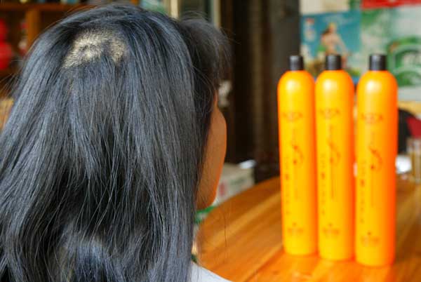 導致頭發變黃脫發的幾種常見原因-易網健康<a href=http://www.jsjjzhkt.cn/jkys/ target=_blank class=infotextkey>養生</a>網 導致頭發變黃脫發的幾種常見原因