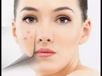 想要去除身體上的痘印應(yīng)該吃什么