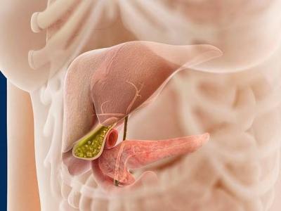 結石患者在生活中可以多吃核桃嗎