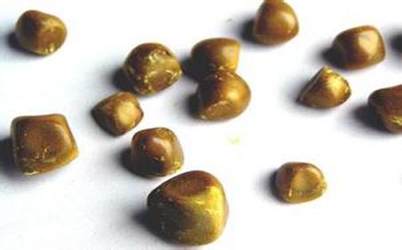 結石患者適合喝什么茶來治療結石-易網健康<a href=http://www.jsjjzhkt.cn/jkys/ target=_blank class=infotextkey>養生</a>網 結石患者適合喝什么茶來治療結石