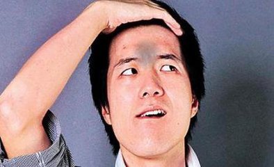 印堂指的是哪印堂發黑是疾病的征兆嗎