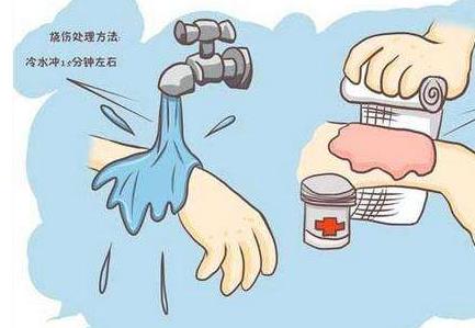 身體上有傷口是裸露好還是包扎好-易網(wǎng)健康<a href=http://www.jsjjzhkt.cn/jkys/ target=_blank class=infotextkey>養(yǎng)生</a>網(wǎng) 身體上有傷口是裸露好還是包扎好