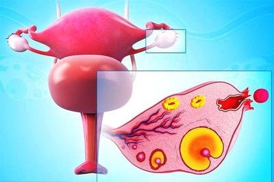 常見的陰道炎分為哪幾大類如何治療陰道炎-易網健康<a href=http://www.jsjjzhkt.cn/jkys/ target=_blank class=infotextkey>養生</a>網 常見的陰道炎分為哪幾大類如何治療陰道炎