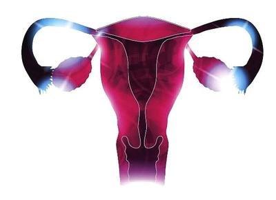 專家教你如何挑選內褲保護子宮的健康