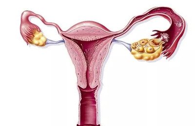 導致卵巢提前走向衰老的原因有哪些-易網健康<a href=http://www.jsjjzhkt.cn/jkys/ target=_blank class=infotextkey>養生</a>網 導致卵巢提前走向衰老的原因有哪些