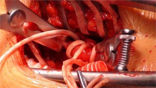 腦血管破裂時你的身體會慢慢顯出這七個體征-易網健康<a href=http://www.jsjjzhkt.cn/jkys/ target=_blank class=infotextkey>養生</a>網 腦血管破裂時你的身體會慢慢顯出這七個體征