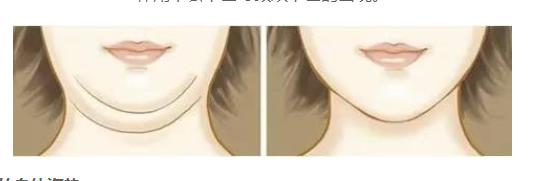為什么會(huì)長(zhǎng)雙下巴的幾種原因