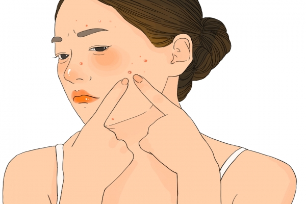 體寒卻肝火旺臉上總長痘怎么調理 寒濕臉上長痘還是濕熱長痘-易網健康<a href=http://www.jsjjzhkt.cn/jkys/ target=_blank class=infotextkey>養生</a>網 體寒卻肝火旺臉上總長痘怎么調理 寒濕臉上長痘還是濕熱長痘