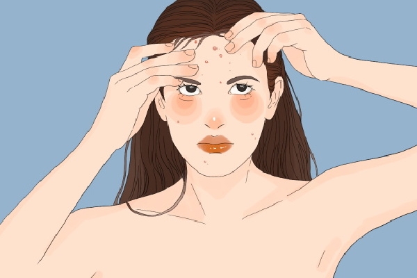 體寒卻肝火旺臉上總長痘怎么調理 寒濕臉上長痘還是濕熱長痘-易網<a href=http://www.jsjjzhkt.cn/ target=_blank class=infotextkey>健康養生</a>網 體寒卻肝火旺臉上總長痘怎么調理 寒濕臉上長痘還是濕熱長痘