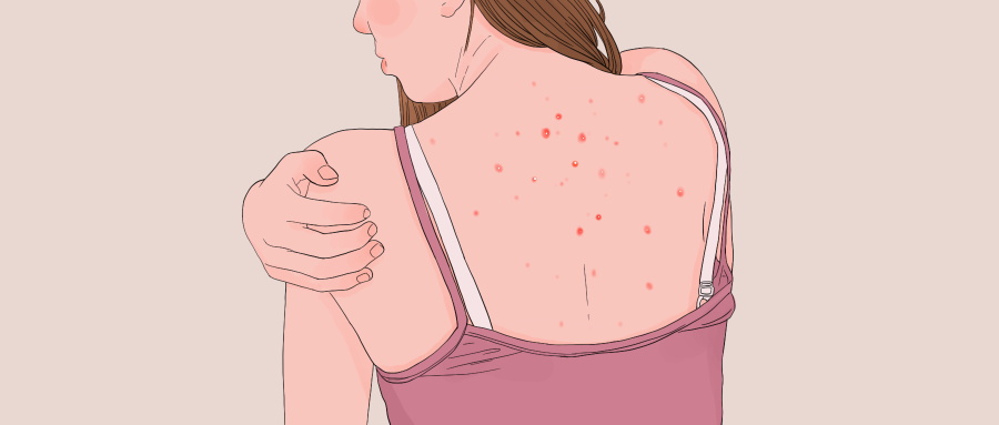 喝祛濕茶要多久有效果 祛濕茶的好處和作用-易網健康<a href=http://www.jsjjzhkt.cn/jkys/ target=_blank class=infotextkey>養生</a>網 喝祛濕茶要多久有效果 祛濕茶的好處和作用