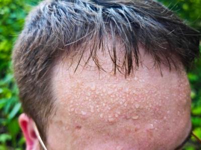 肝火旺可以汗蒸出汗嗎 一動就出汗跟肝火旺有關系嗎