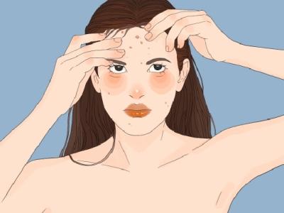 上火長痘痘怎么調理去火 上火冒痘吃什么降火