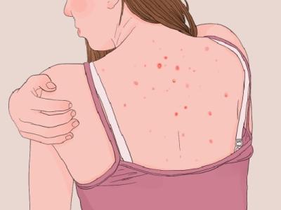 怎么判斷自己濕氣重不重 人體內濕氣重如何解決