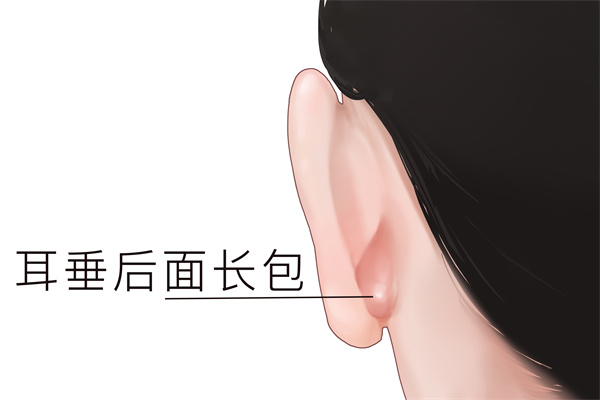 耳朵后面突然鼓起一個硬包-易網(wǎng)<a href=http://www.jsjjzhkt.cn/ target=_blank class=infotextkey>健康養(yǎng)生</a>網(wǎng) 耳朵后面突然鼓起一個硬包