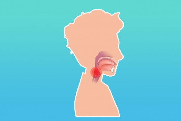 慢性咽炎治療方法