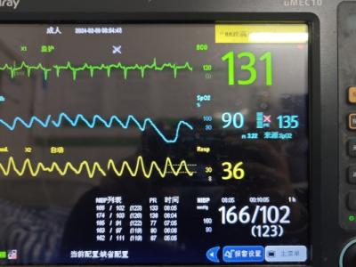 竇性心律不齊是指什么意思