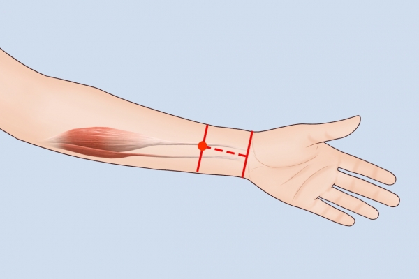 內關穴按摩的好處 按摩內關穴的正確方法