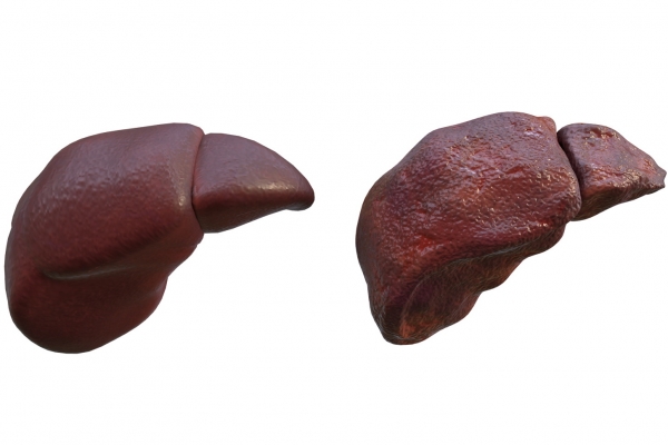 肝硬化能吃羊肉嗎-易網(wǎng)健康<a href=http://www.jsjjzhkt.cn/jkys/ target=_blank class=infotextkey>養(yǎng)生</a>網(wǎng) 肝硬化能吃羊肉嗎