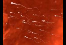 夫妻生活進(jìn)行時男性出血的原因