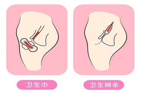 衛生棉條解放女性自由 許多人卻擔心它會弄破處女膜？