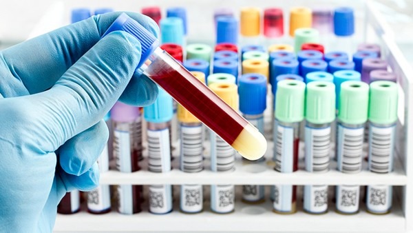 性激素六項檢查注意事項有哪些 性激素六項的參考范圍是什么-易網<a href=http://www.jsjjzhkt.cn/ target=_blank class=infotextkey>健康養生</a>網 性激素六項檢查注意事項有哪些 性激素六項的參考范圍是什么