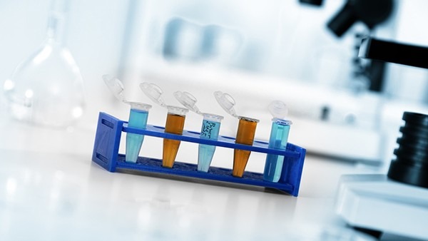 性激素六項檢查注意事項有哪些 性激素六項的參考范圍是什么-易網健康<a href=http://www.jsjjzhkt.cn/jkys/ target=_blank class=infotextkey>養生</a>網 性激素六項檢查注意事項有哪些 性激素六項的參考范圍是什么