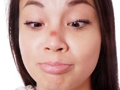 體外射精避孕法為何不靠譜 體外射精避孕的優(yōu)點都有哪些