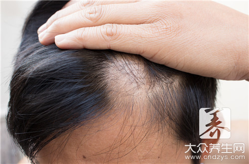 縱欲過度掉頭發(fā)還長嗎-易網(wǎng)健康<a href=http://www.jsjjzhkt.cn/jkys/ target=_blank class=infotextkey>養(yǎng)生</a>網(wǎng) 縱欲過度掉頭發(fā)還長嗎