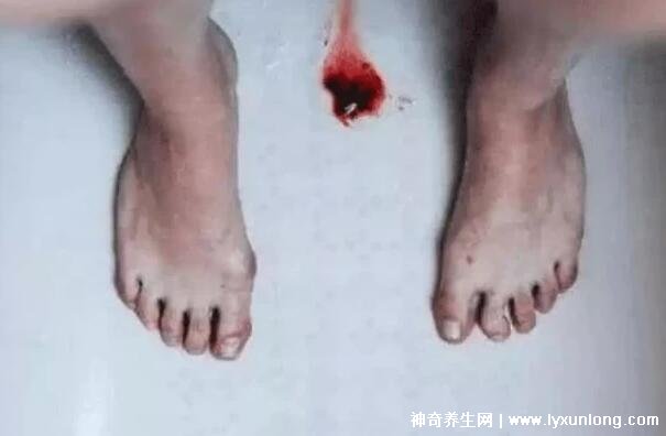 真實女生內膜破壞的圖片,剝脫的子宮內膜伴隨經血排出-易網健康<a href=http://www.jsjjzhkt.cn/jkys/ target=_blank class=infotextkey>養生</a>網 真實女生內膜破壞的圖片,剝脫的子宮內膜伴隨經血排出