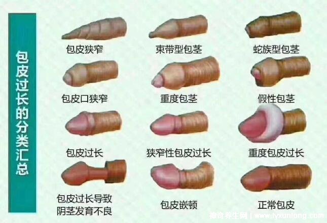 老公割包之后好像沒有那么厲害了,因?yàn)楦舾辛?5個(gè)原因)-易網(wǎng)<a href=http://www.jsjjzhkt.cn/ target=_blank class=infotextkey>健康養(yǎng)生</a>網(wǎng) 老公割包之后好像沒有那么厲害了,因?yàn)楦舾辛?5個(gè)原因)