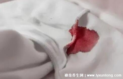 宮頸癌褐色分泌物圖片,少量不規(guī)則出血伴隨X交痛(腥臭分泌物)-易網(wǎng)健康養(yǎng)生網(wǎng) 宮頸癌褐色分泌物圖片,少量不規(guī)則出血伴隨X交痛(腥臭分泌物)