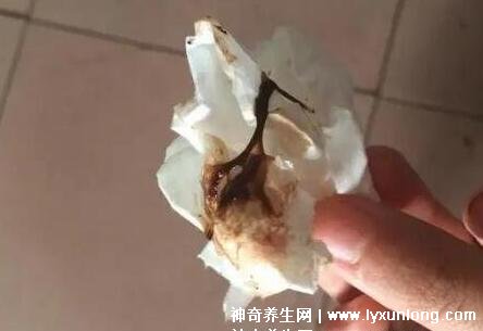 宮頸糜爛一二三度圖片,真實對比照片(小心是宮頸癌前兆)-易網健康養生網 宮頸糜爛一二三度圖片,真實對比照片(小心是宮頸癌前兆)