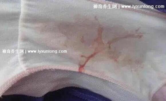 真實宮頸癌的早期出血圖片，接觸性出血是最明顯癥狀(女性必看)