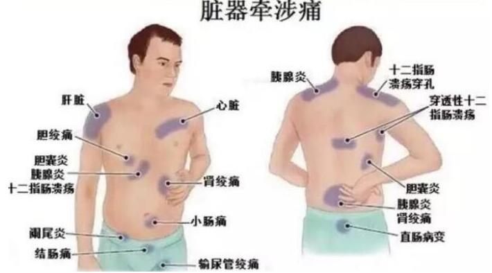 女性后背疼警惕四種病,腰部周圍痛小心婦科病(疼痛位置圖解)-易網健康養生網 女性后背疼警惕四種病,腰部周圍痛小心婦科病(疼痛位置圖解)