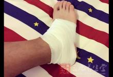 韌帶扭傷怎么辦 治療韌帶扭傷的方法