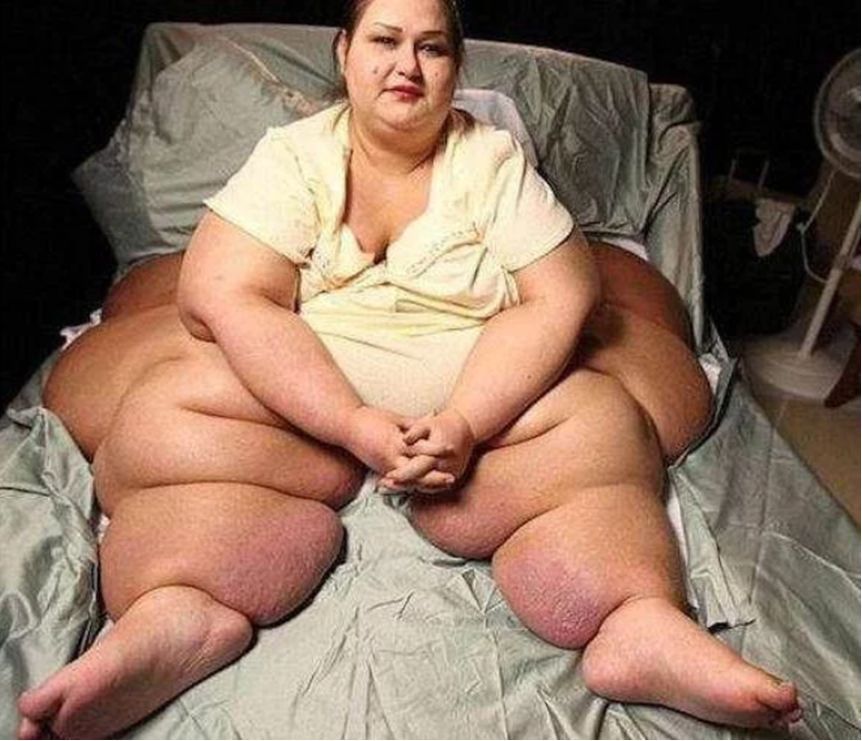 千斤女子暴瘦650斤，成功從生活不能自理到擁有姣好身材