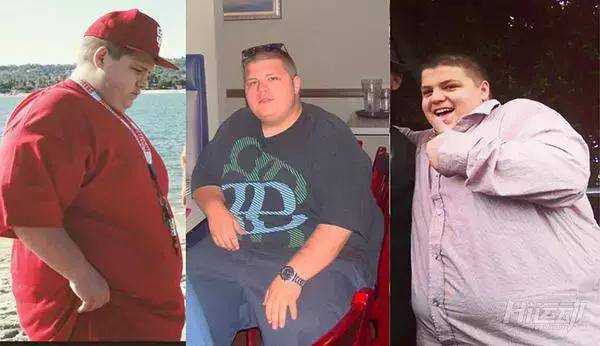 胖子成功減肥200斤，皮膚松弛也坦然面對！