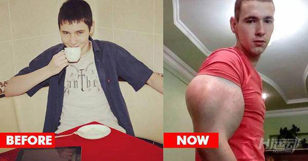 俄羅斯小伙靠“隆”手臂成網(wǎng)紅？用生命在作死！手臂爆了