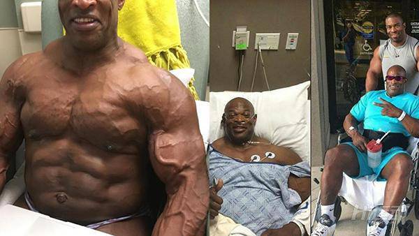 頭頂8個奧林匹亞冠軍，“祖師爺”身上已經打滿鋼釘！