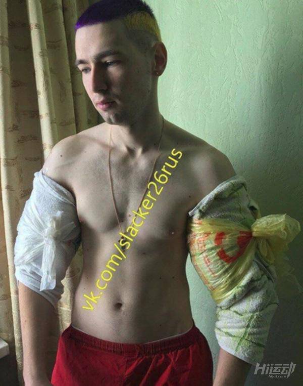 俄羅斯小伙靠“隆”手臂成網(wǎng)紅？用生命在作死！手臂爆了