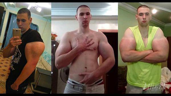 俄羅斯小伙靠“隆”手臂成網(wǎng)紅？用生命在作死！手臂爆了