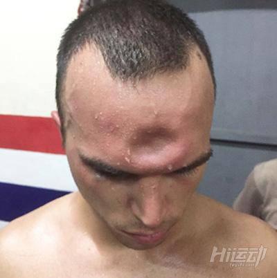 為什么終止比賽？我還沒打夠呢！