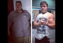 胖子成功減肥200斤，皮膚松弛也坦然面對！